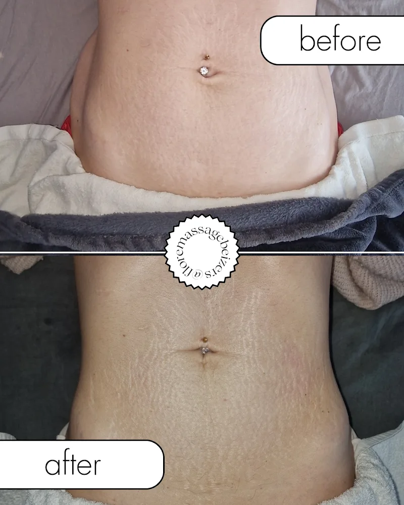 Flore massage, drainage lymphatique et maderotherapie
