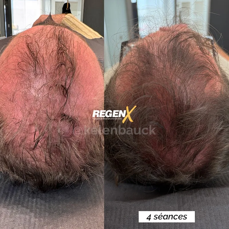 Florine CORRENT Reconstruction Sourcils /Barbe /Cheveux_Ajaccio _ Skincare Anti-âge Haut de Gamme