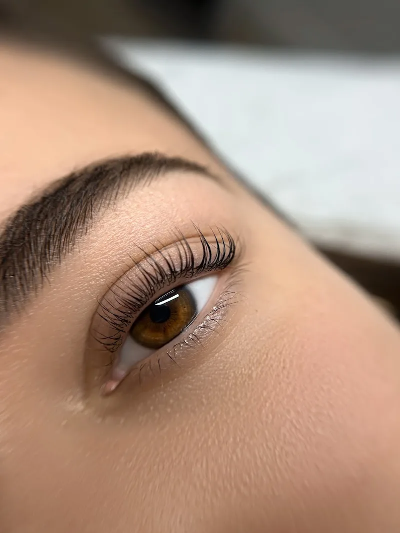 MERVE KARA | institut de beauté, centre de laser et minceur