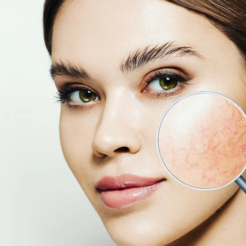 CLINIQUE LASER Nîmes - Dr PORTE Rachelle