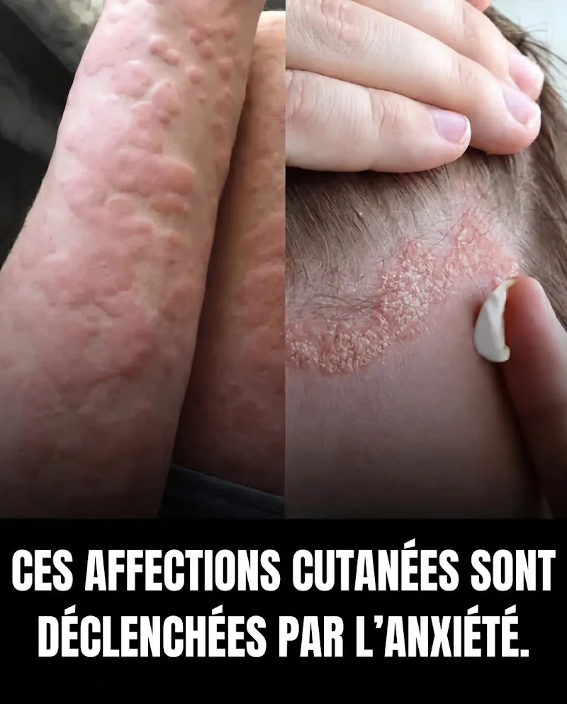My Laser Bordeaux - Epilation laser & Médecine esthétique