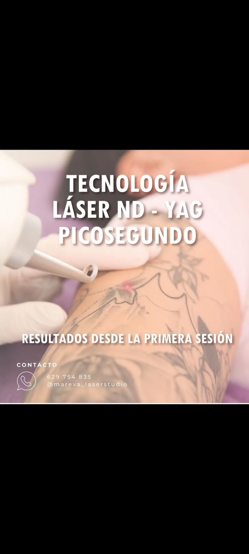 Mareva Láser Studio - Institut de beauté Getafe - Photo de couverture - OneBooking
