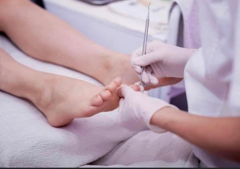 Pédicure Médical