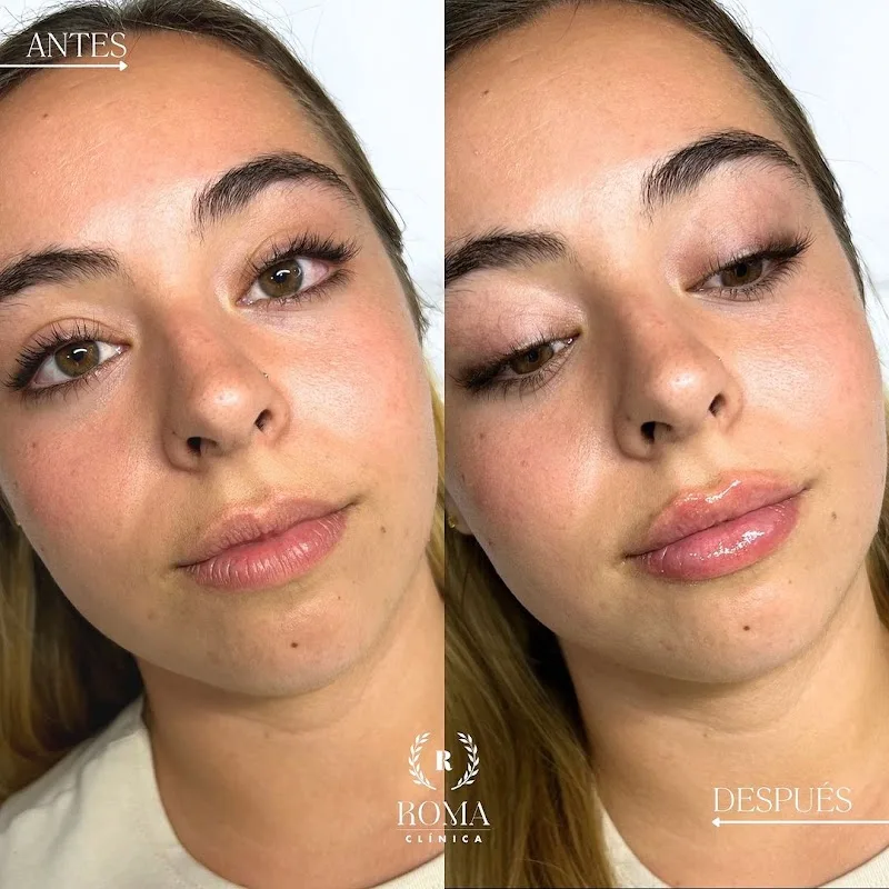 Clínica Roma - Medicina Estética Málaga - Esthétique Málaga - OneBooking