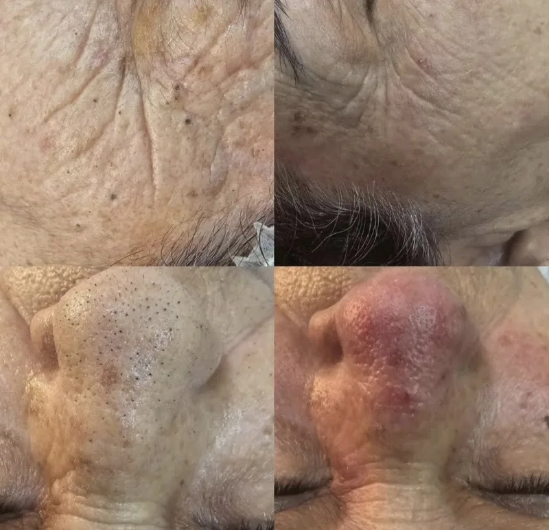 MirySkin Beauty Estetica Avanzada Profesional - Esthétique Málaga - OneBooking
