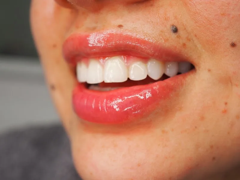 Ckath Estudio - Centro de Estética Facial